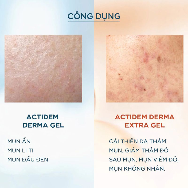 Gel Giảm Mụn, Mờ Thâm Actidem Derma Gel 18g