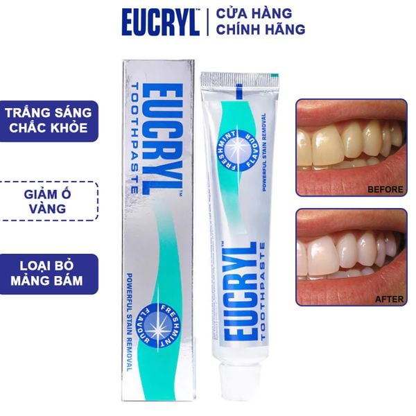 Kem Đánh Trắng Răng Hương Bạc Hà Thơm Mát Eucryl Toothpaste Freshmint 62g