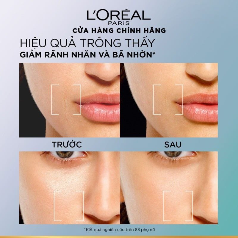 Kem Dưỡng HA Cấp Ẩm, Kiềm Dầu L'oreal Paris Revitalift Hyaluronic Acid 8H Oil Control Gel-Cream 50ml