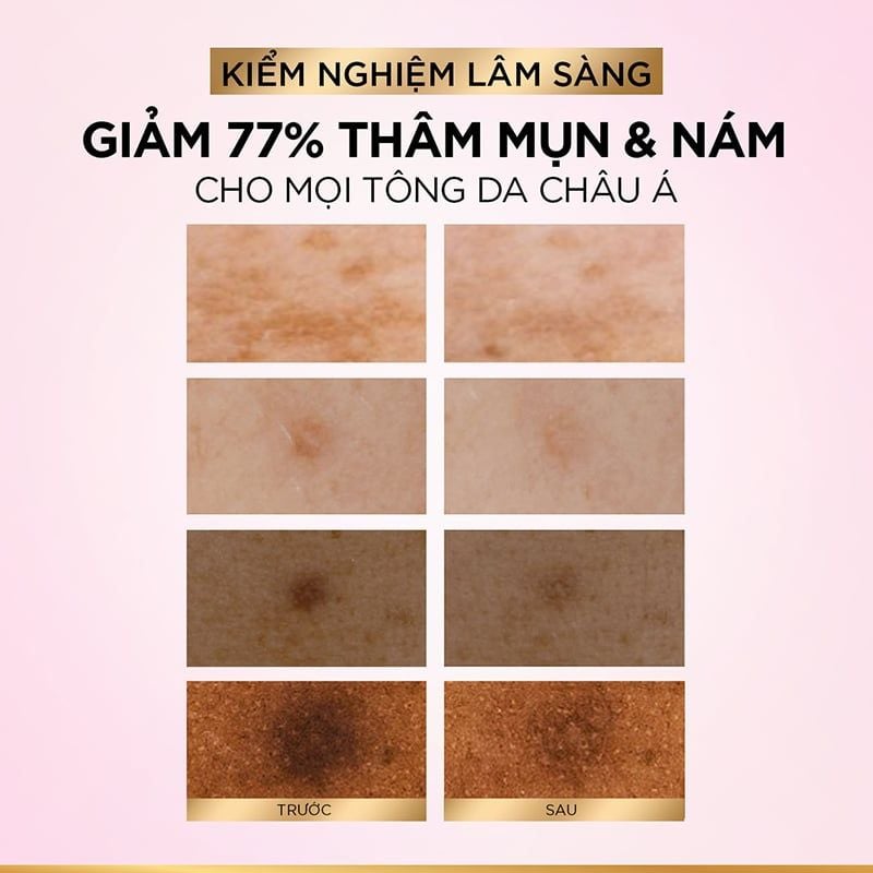 [VOUCHER 40K] Serum L'oreal Tinh Chất Mờ Thâm Nám Glycolic-Bright Instant Glowing Serum