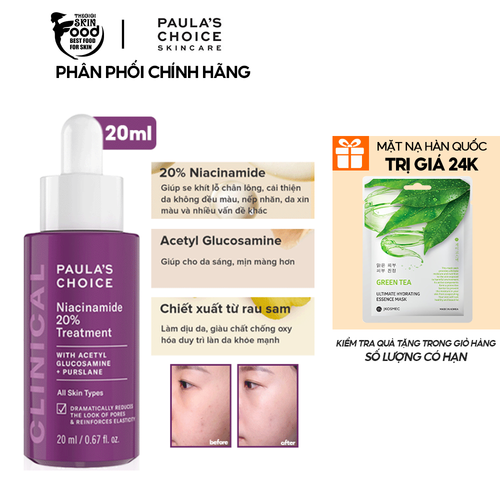 Tinh Chất Dưỡng Da, Thu Nhỏ Lỗ Chân Lông Paula's Choice Niacinamide 20% Treatment 20ml