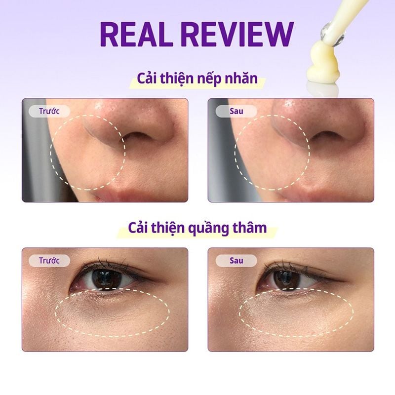 Kem Dưỡng Mắt Some By Mi Cải Thiện Quầng Thâm, Hỗ Trợ Dưỡng Sáng Da Retinol Intense Advanced Triple Action Eye Cream 30ml