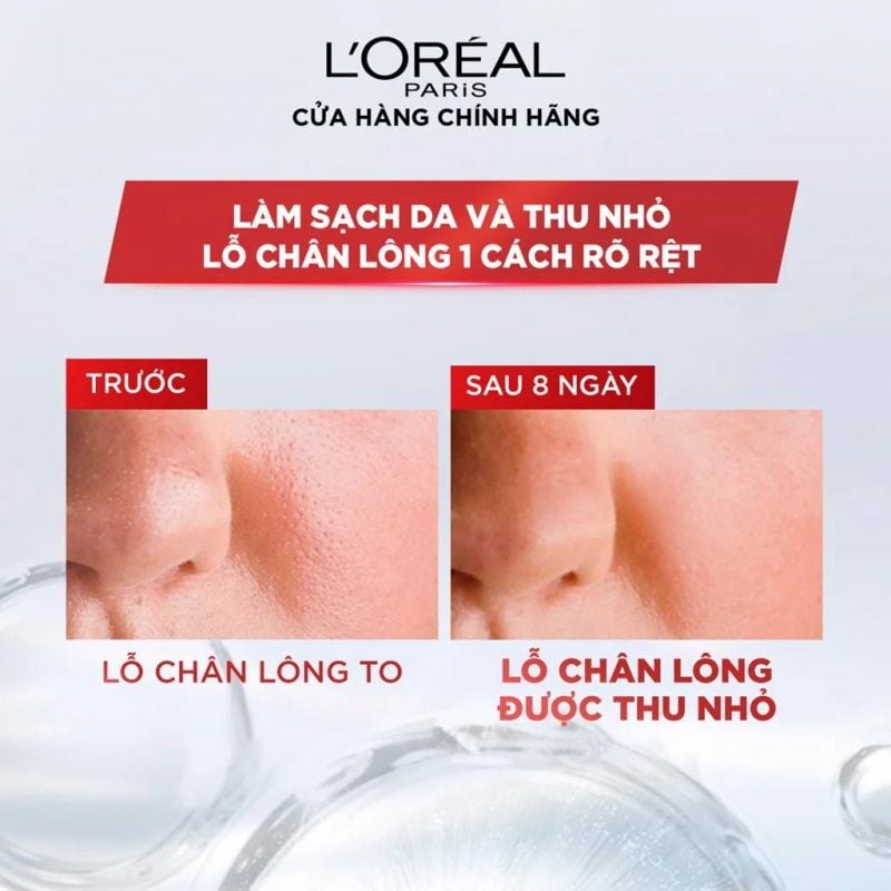 Nước Tẩy Trang Làm Sạch Cho Da Dầu L'oreal Revitalift Crystal Purifying Micellar Water