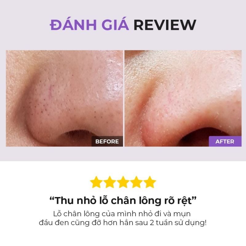 Tẩy Tế Bào Chết Hóa Học Cosrx Hỗ Trợ Giảm Đầu Đen, Mụn Ẩn, Lỗ Chân Lông To BHA Blackhead Power Liquid 50ml