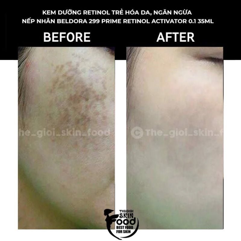 Kem Dưỡng Retinol Beldora 299 Cải Thiện Nếp Nhăn Dành Cho Da Nhạy Cảm Prime Retinol Activator 0.1 35ml