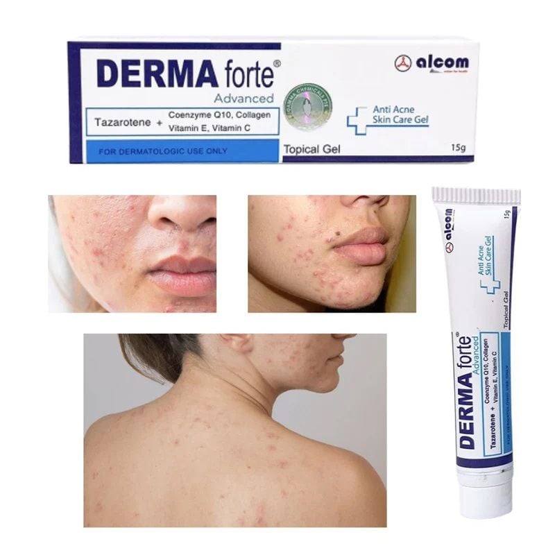 Gel Hỗ Trợ Giảm Mụn, Giảm Thâm Derma Forte Topical Gel 15g