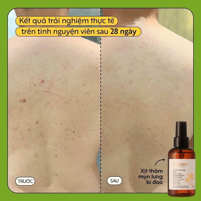 Xịt Giảm Thâm Mụn Lưng, Làm Dịu Da Chiết Xuất Bí Đao Cocoon Winter Melon Dark Spots & Acne Spray For Back 140ml