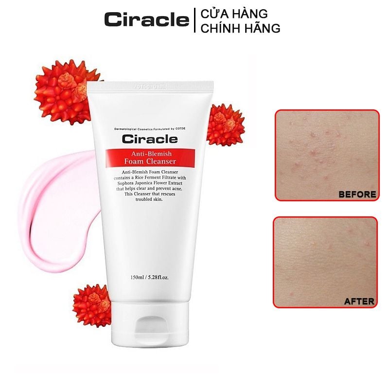 Sữa Rửa Mặt Tạo Bọt Ngăn Ngừa Mụn, Kiềm Dầu Ciracle Anti-Blemish Foam Cleanser 150ml