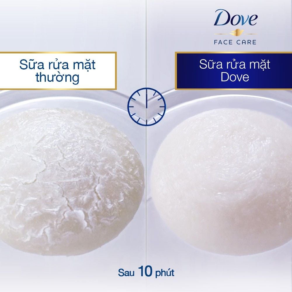 [Tuýp 130g] Sữa Rửa Mặt Tinh Chất Dove Kiềm Dầu Và Thu Nhỏ Lỗ Chân Lông Beauty Serum Facial Cleansing Foam For Less Visible Pores And Oil Control