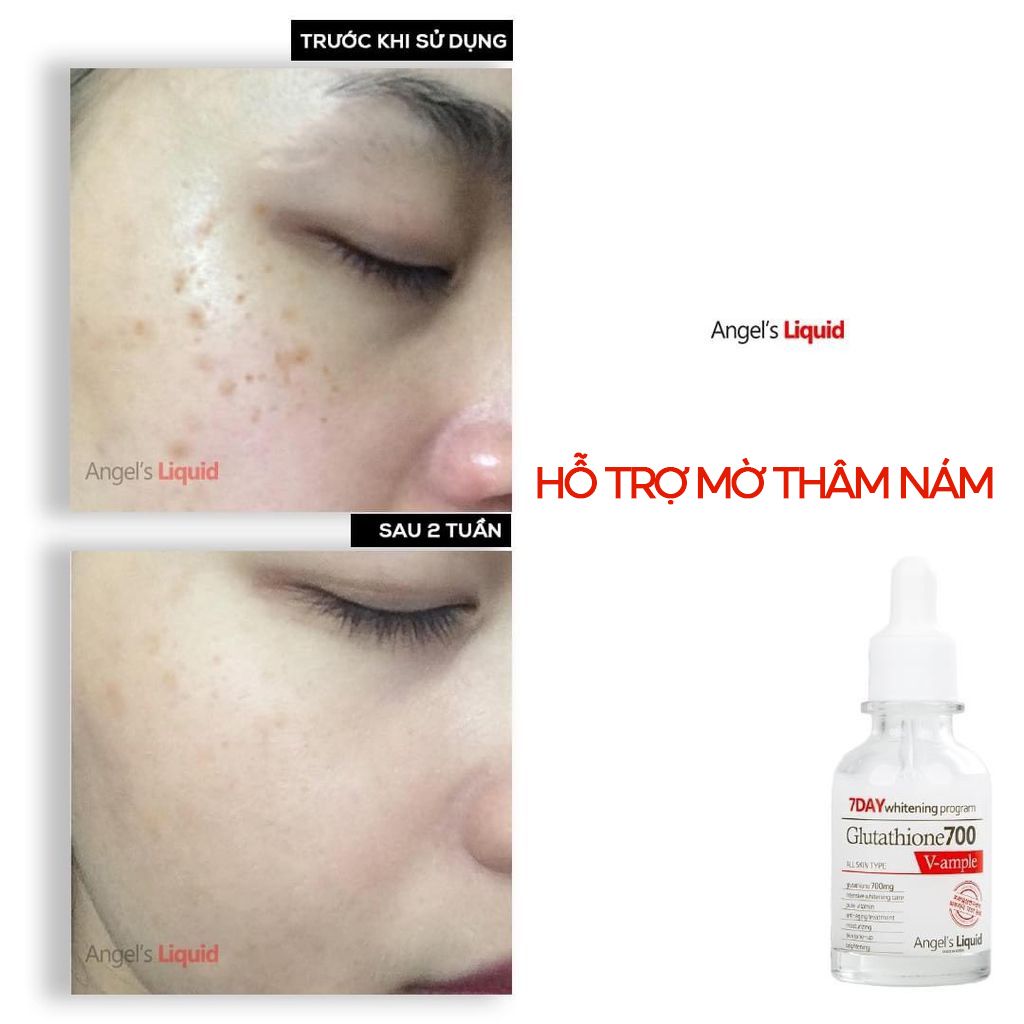 Serum Angel's Liquid Huyết Thanh Hỗ Trợ Dưỡng Trắng Da, Làm Mờ Thâm Nám Glutathione 700 V-Ampoule 30ml