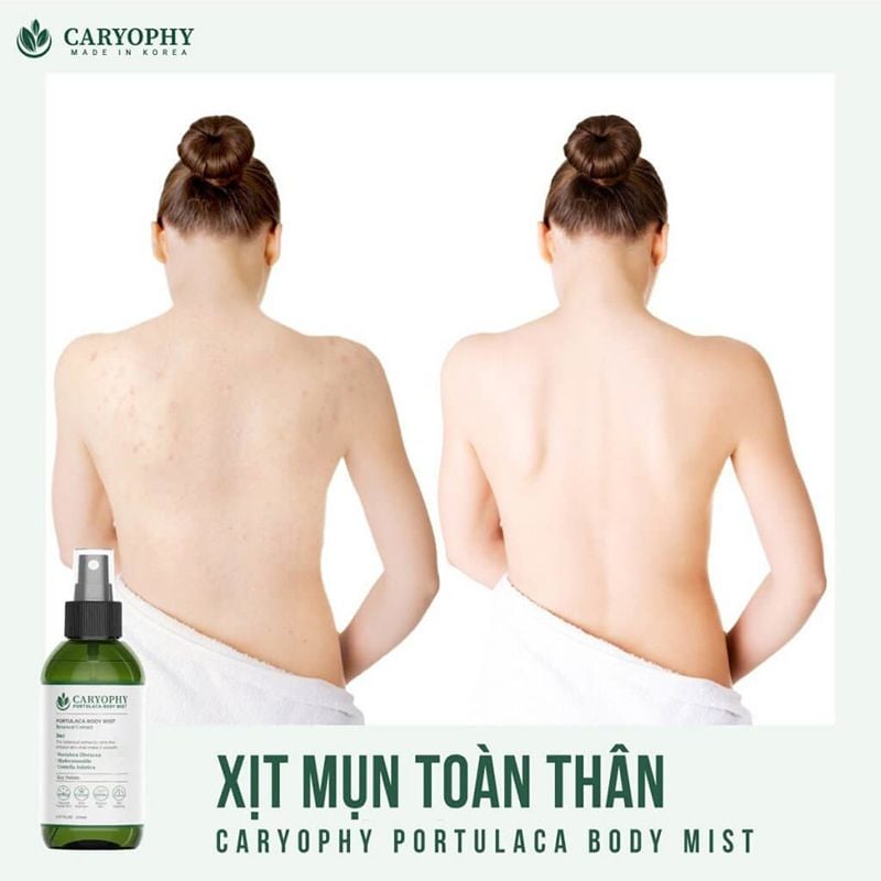 Xịt Hỗ Trợ Cải Thiện Mụn Toàn Thân Caryophy Portulaca Body Mist 150ml