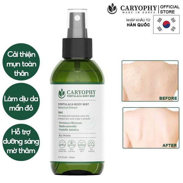 Xịt Hỗ Trợ Cải Thiện Mụn Toàn Thân Caryophy Portulaca Body Mist 150ml