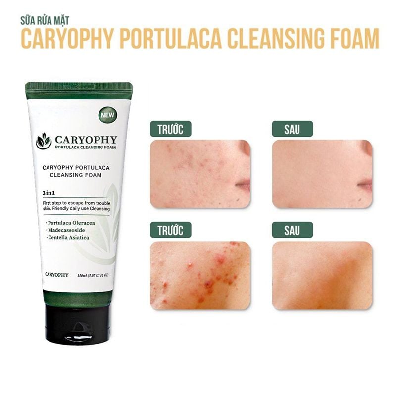Sữa Rửa Mặt Caryophy Làm Sạch Sâu, Phục Hồi Da Portulaca Cleansing Foam 150ml