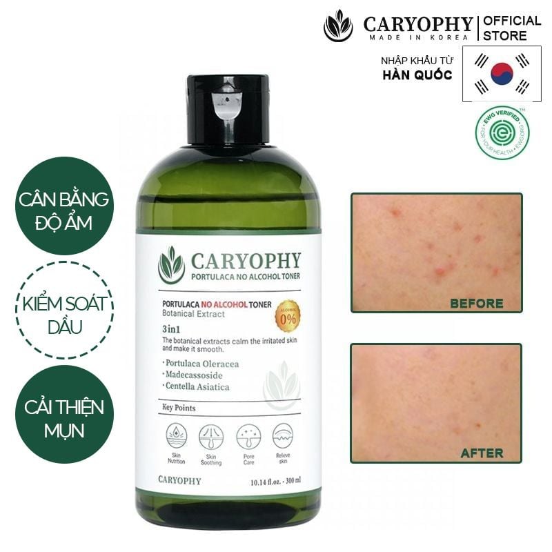 Nước Hoa Hồng Caryophy Chăm Sóc Da Dầu Mụn Portulaca Toner 300ml