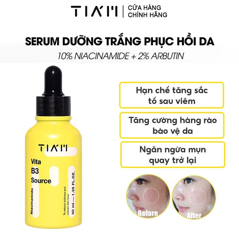 Tinh Chất Dưỡng Trắng Da Phục Hồi Da Sau Mụn Tiam Vita B3 Source Serum –  THẾ GIỚI SKINFOOD