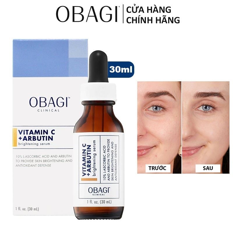 Serum Obagi Tinh Chất Dưỡng Trắng Da Obagi Clinical Vitamin C + Arbutin Brightening Serum 30ml