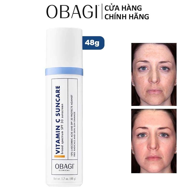 Kem Chống Nắng Hỗ Trợ Dưỡng Sáng Da Obagi Clinical Vitamin C Suncare SPF 30 48g