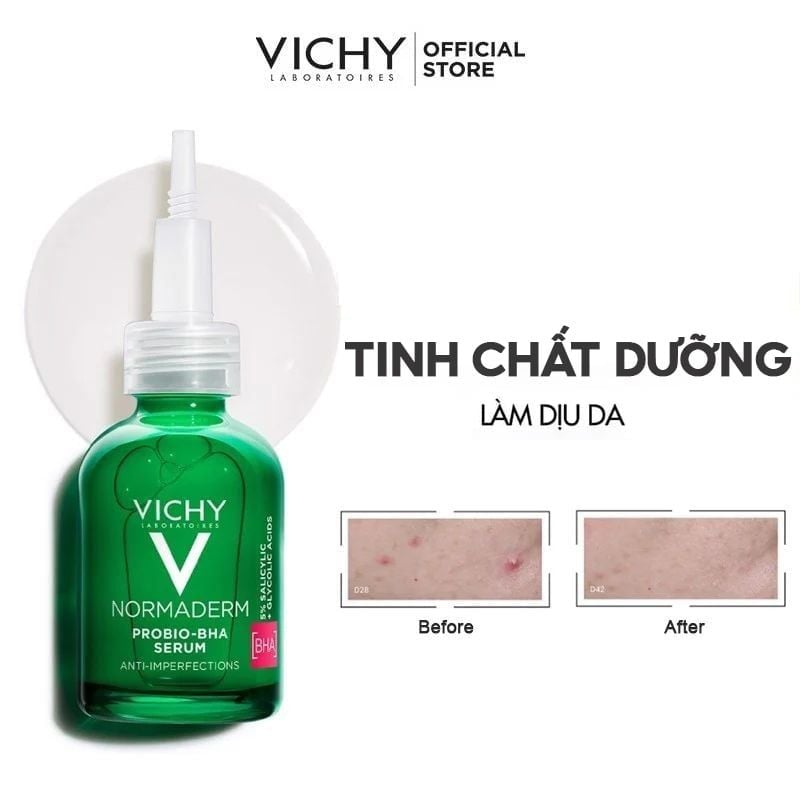Serum Vichy Làm Dịu Da, Cải Thiện Da, Hỗ Trợ Giảm Mụn Normaderm Probio-BHA Anti Imperfections Serum 30ml