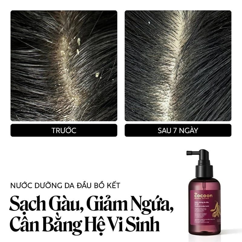 Nước Dưỡng Da Đầu Cocoon Bồ Kết Làm Giảm Gàu, Chăm Sóc Da Đầu Gleditsia Scalp Tonic