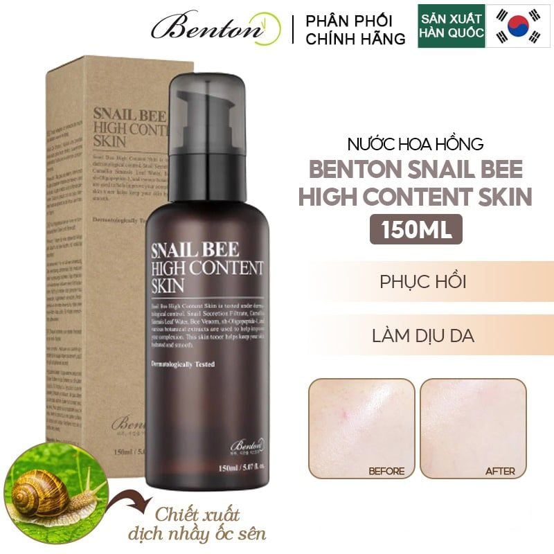 Nước Hoa Hồng Hỗ Trợ Phục Hồi, Làm Dịu Da Benton Snail Bee High Content Skin 150ml