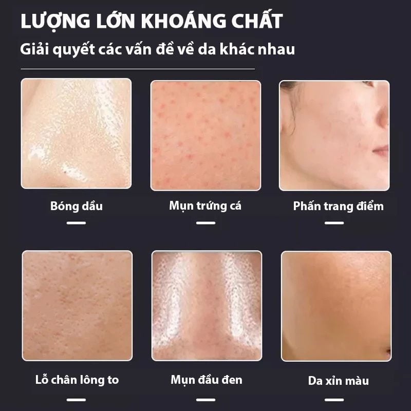 [NHẬP KHẨU] Con Lăn Đá Núi Lửa Hút Dầu, Làm Sạch Da RuiXinLi Oil Absorbing Roller