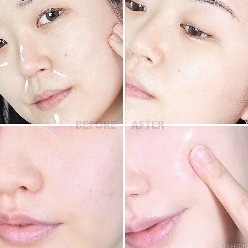 Kem Dưỡng Nâng Cơ, Cải Thiện Độ Đàn Hồi, Căng Mịn Sur.Medic+ Super Peptide 100 Collagen Lifting Cream 50ml