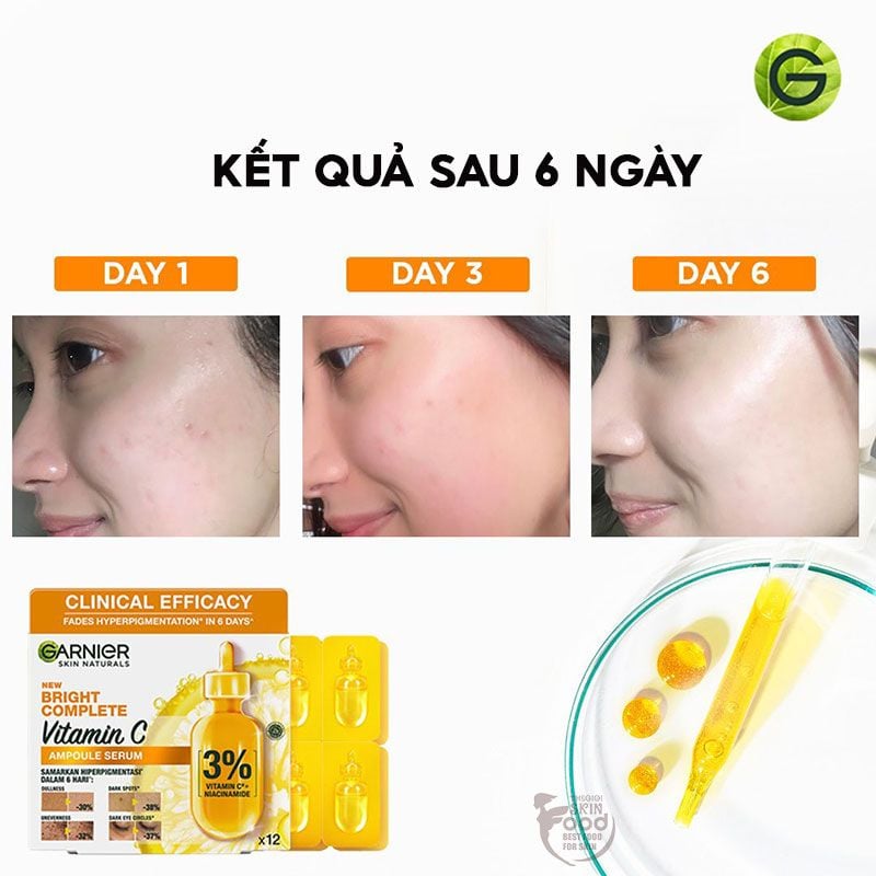Serum Garnier Tinh Chất Cô Đặc Hỗ Trợ Dưỡng Sáng Da Mờ Thâm New Bright Complete Vitamin C Ampoule Serum 12 x 1.5ml