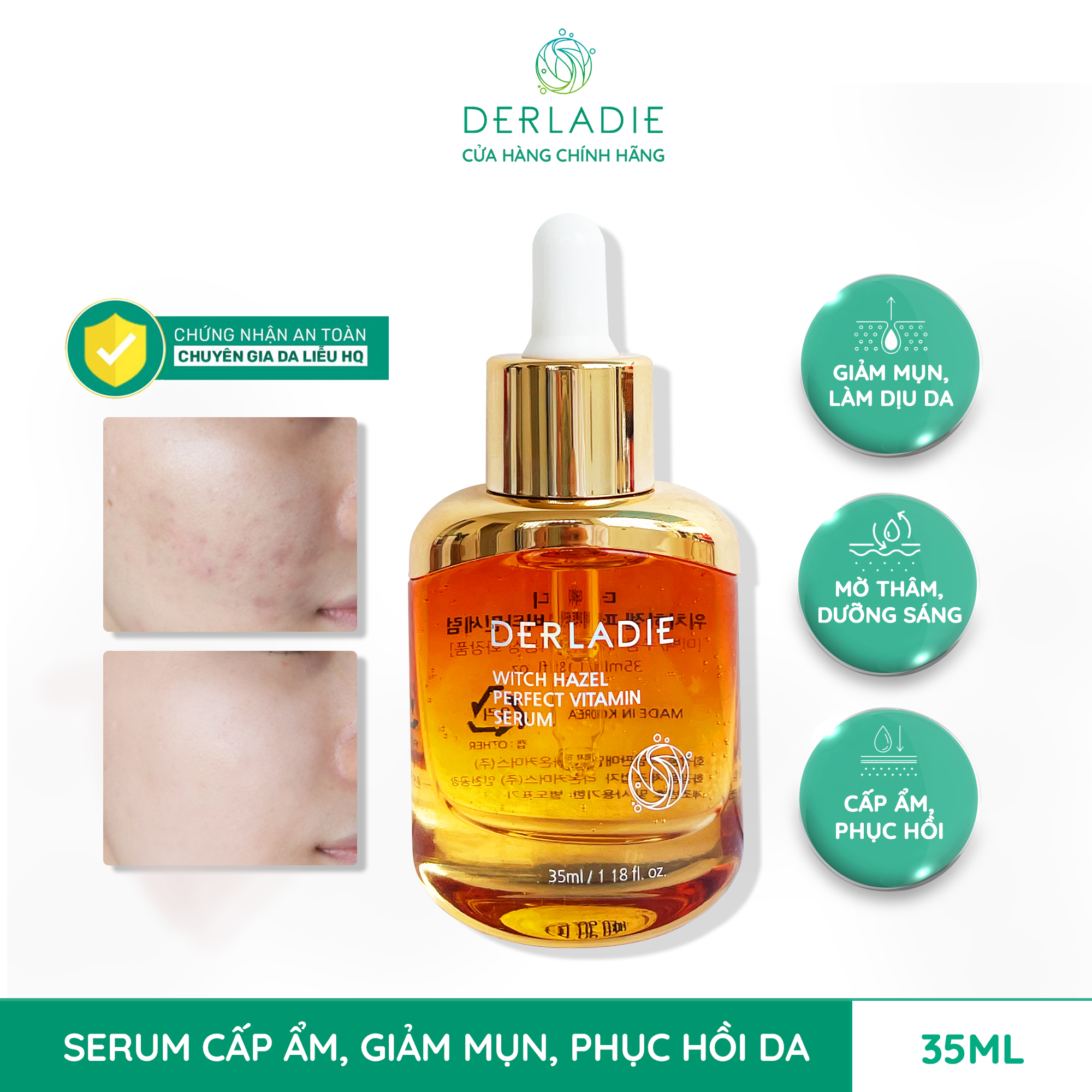 Tinh Chất Trị Mụn Derladie Witch Hazel Perfect Vitamin Serum – THẾ GIỚI  SKINFOOD