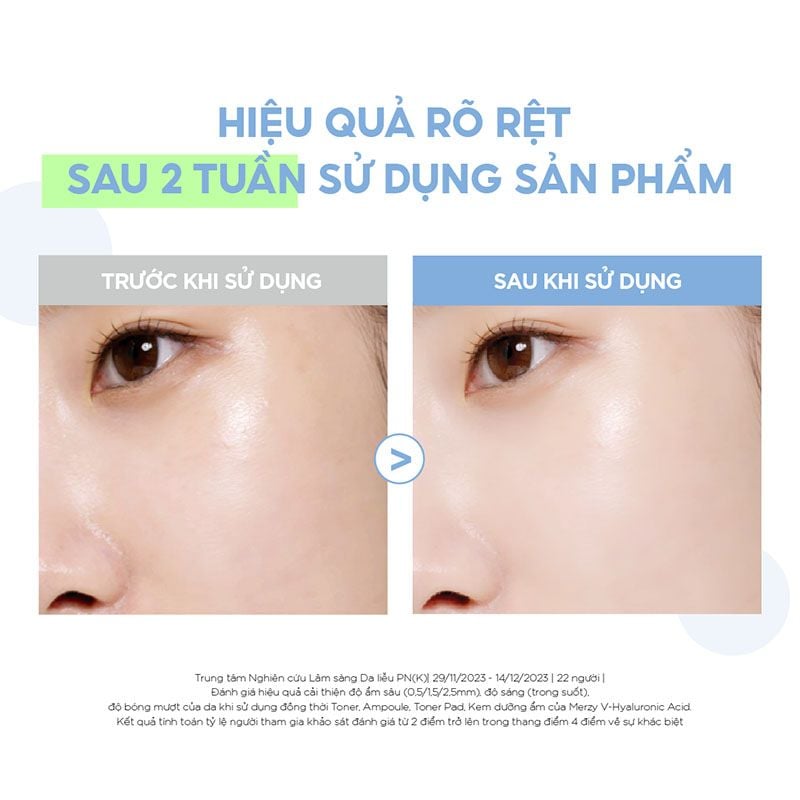 Tinh Chất Dưỡng Ẩm Chuyên Sâu, Căng Mịn Da By Merzy V-Hyaluronic Acid Moisture Ampoule 100ml
