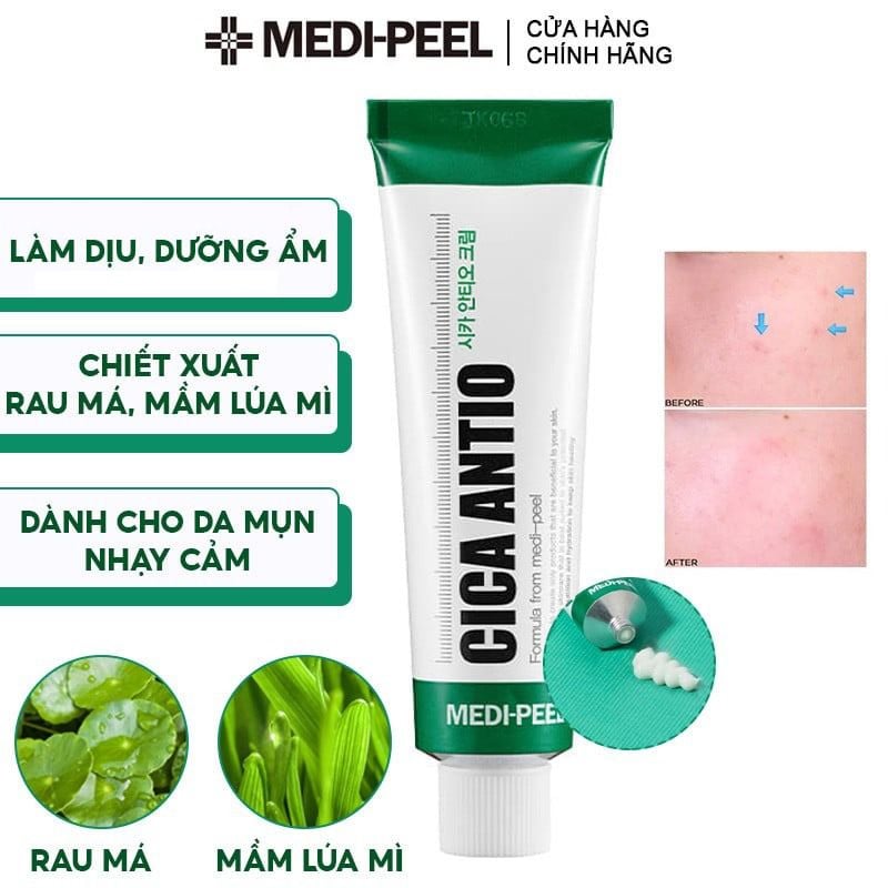 Kem Dưỡng Medi-Peel Làm Dịu, Cải Thiện Da Cica Antio Cream 30ml