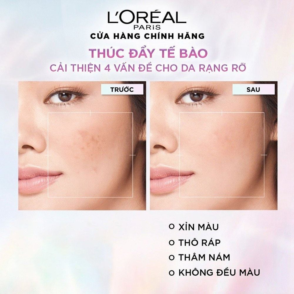 Kem Dưỡng Ban Ngày Hỗ Trợ Mờ Thâm Nám L'Oreal Glycolic Bright Glowing Cream Day