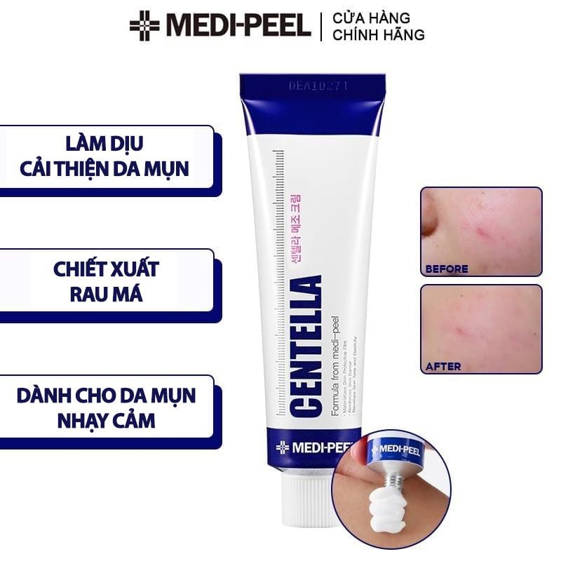 Kem Dưỡng Cải Thiện Da Mụn Medi-Peel Centella Mezzo Cream 30ml