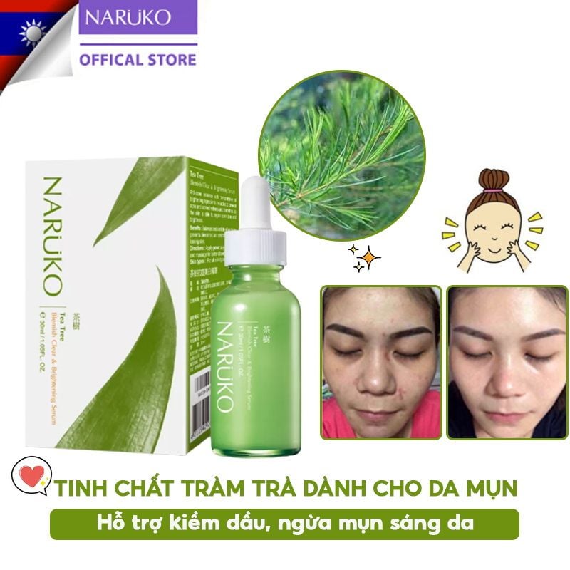 Serum Naruko Tràm Trà Dành Cho Da Mụn Kiềm Dầu Dưỡng Sáng Da Naruko Tea Tree Blemish Clear & Brightening Serum 30ml