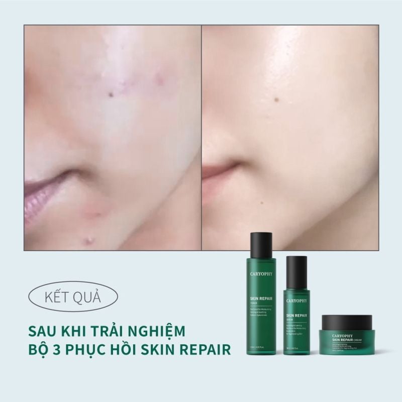 Nước Hoa Hồng Cấp Nước, Làm Dịu Da Caryophy Skin Repair Toner 120ml