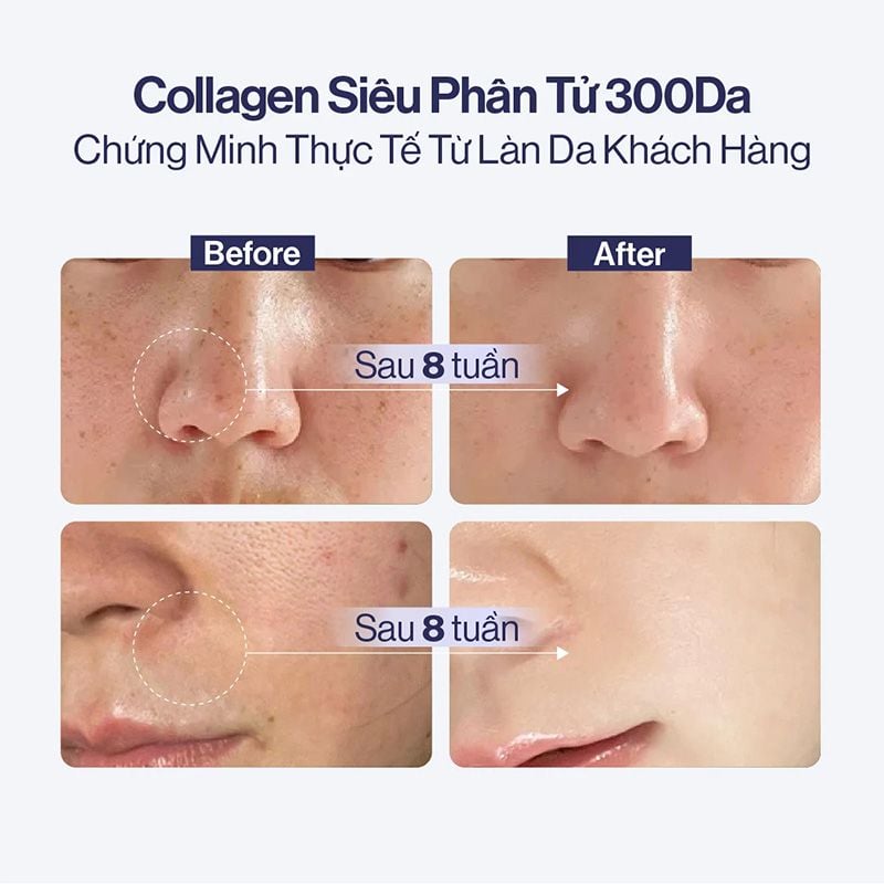 Nước Uống Collagen Siêu Phân Tử 300DA Trẻ Hóa, Hỗ Trợ Dưỡng Sáng, Cân Bằng Nội Tiết Gilaa 5K Collagen Booster 15 gói x 20g