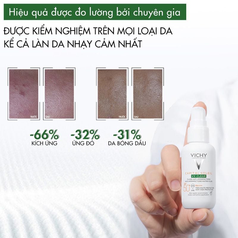 Kem Chống Nắng Vichy Dành Cho Da Dầu Mụn Capital Soleil UV-Clear SPF 50+ PA++++ 40ml