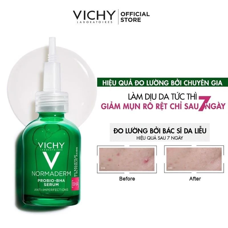 Serum Vichy Tinh Chất Dưỡng Làm Dịu Da, Cải Thiện Da, Giảm Mụn Vichy Normaderm Probio-BHA Anti Imperfections Serum 30ml
