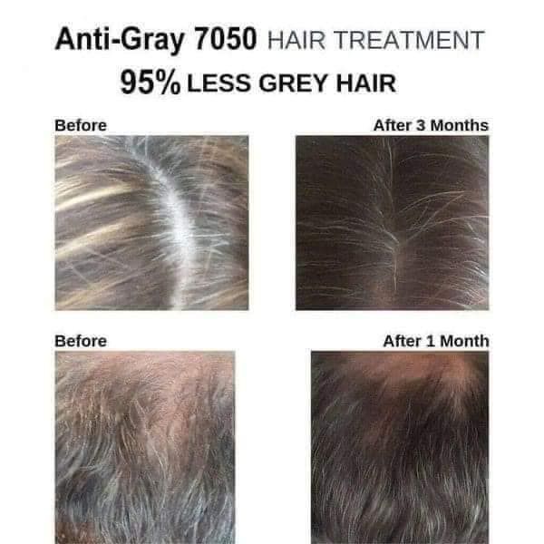 Viên uống trị tóc bạc sớm Super Anti Gray Hair 7050
