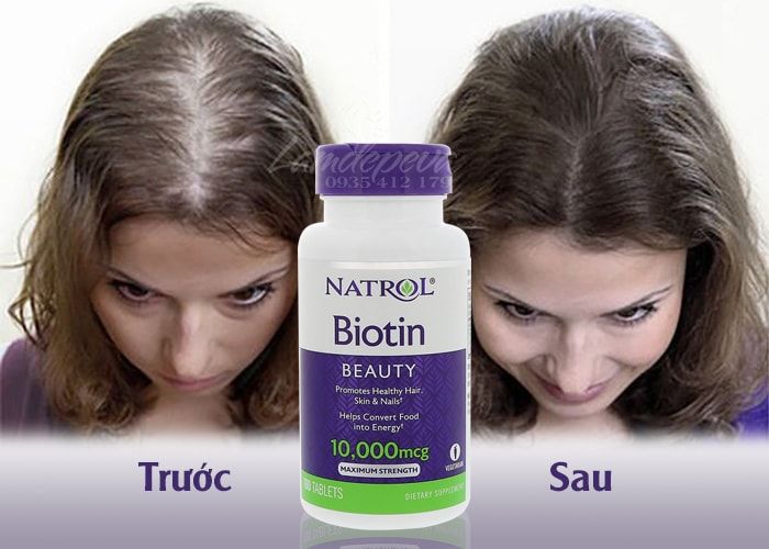 Viên uống hỗ trợ mọc tóc và chống rụng tóc Natrol Biotin Beauty 10,000mcg