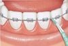 Tăm nha khoa hương bạc hà Sunstar Gum Soft Picks Advanced Mint