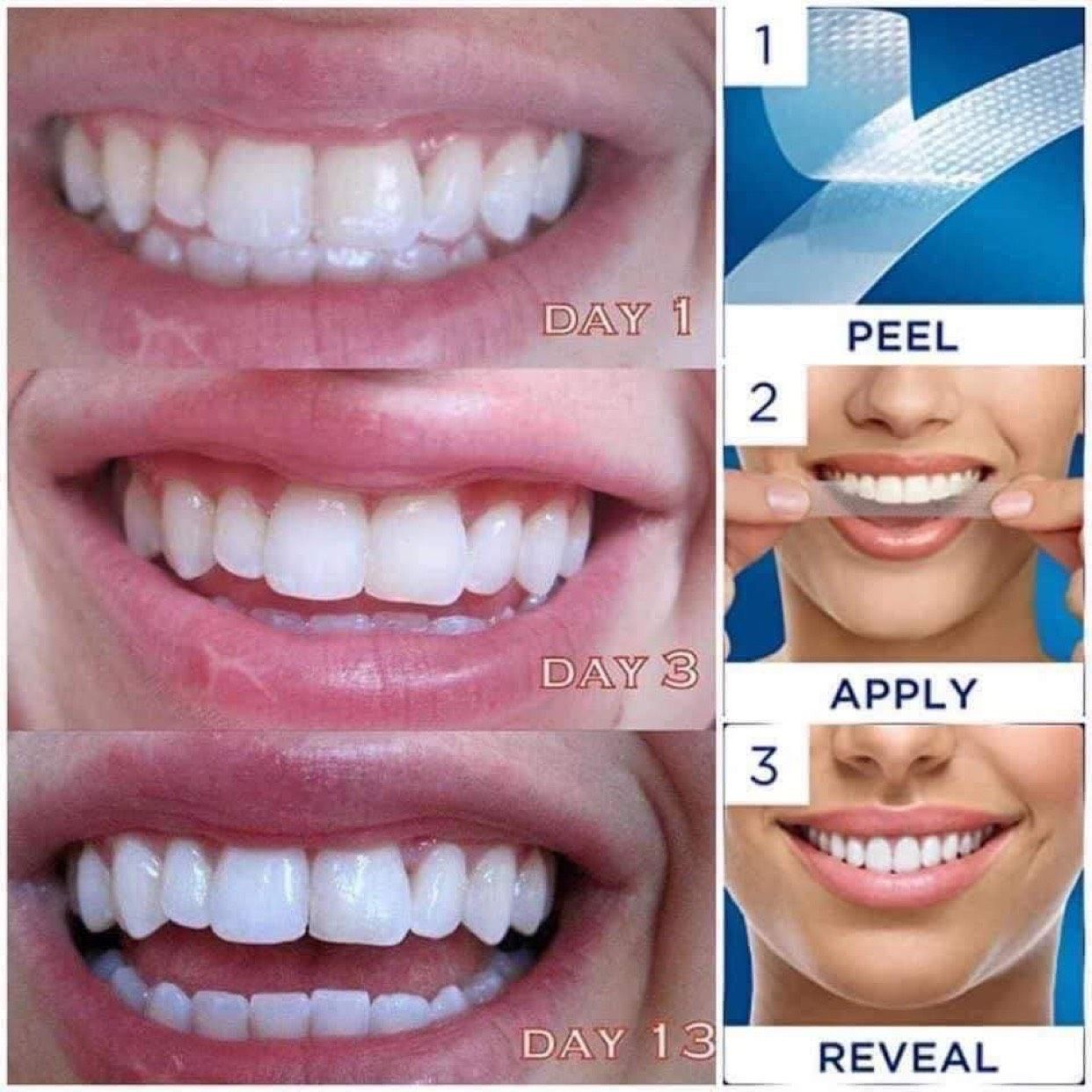 Miếng dán trắng răng cao cấp Crest 3D White