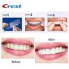 Miếng dán trắng răng cao cấp Crest 3D Whitestrips