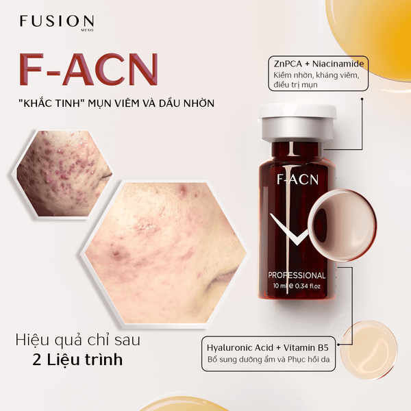 Meso FUSION F-ACN giảm mụn, thâm và ngăn chặn mụn