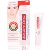 Kem trị mụn phục hồi da Vin21 Anti - Acne Cream +4Zinc
