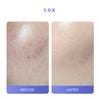 Tái tạo và trẻ hóa da SRX Retinol A Cream