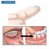  Sáp nha Curaprox Ortho Wax cho răng niềng 
