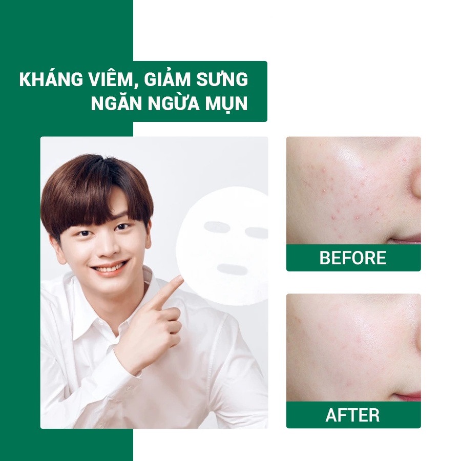 Mặt Nạ Chiết Xuất Tràm Trà Làm Dịu Da, Giảm Mụn Some By Mi Tea Tree Calming Glow Luminous Ampoule Mask 25g