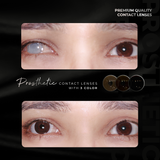  The Aesthetic Contact Lens - The Concealed Contact Lens 