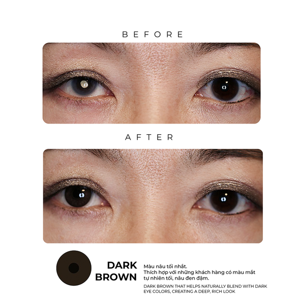  The Aesthetic Contact Lens - The Concealed Contact Lens 