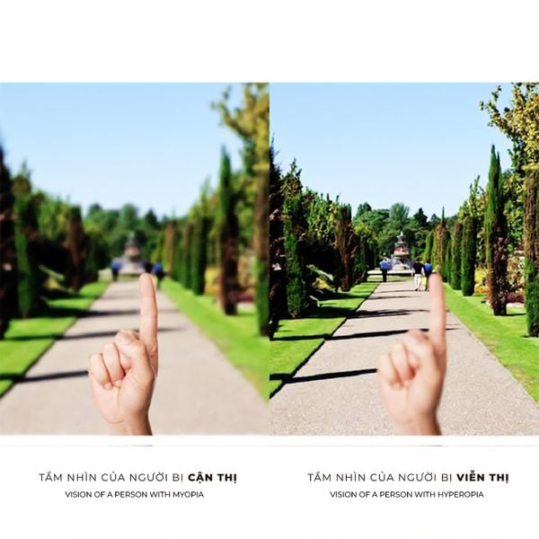  Premium Clear Hyperopia Contact Lenses from Korea – Available in Powers from +0.50 to +6.00 